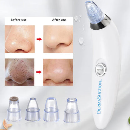 Derma Pore Cleaner Acne Oil Remover