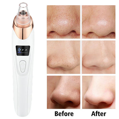 Derma Pore Cleaner Acne Oil Remover