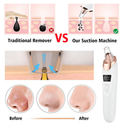 Derma Pore Cleaner Acne Oil Remover